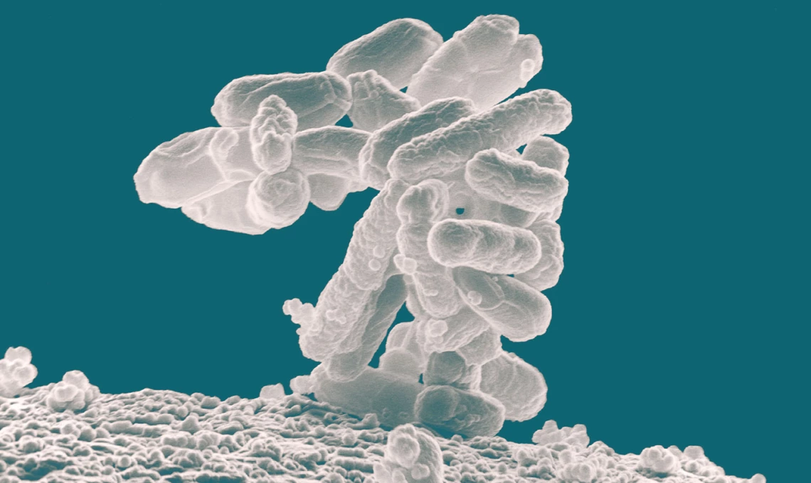 e coli bacteria